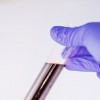 The litigants claim that Theranos CEO Elizabeth Holmes lied about the technology used for carrying out blood tests. (Pixabay)