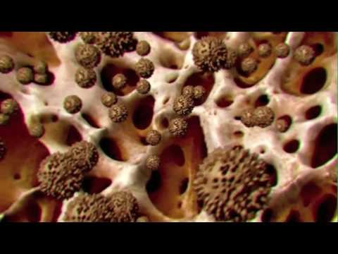 Scientists have discovered a new way to destroy cancer cells using nanocages. (YouTube)