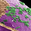 Researchers have discovered that gut bacteria affects the manifestation of the symptoms of Parkinson's disease. (Pacific Northwest National Laboratory - PNNL / CC BY-NC-SA 2.0)