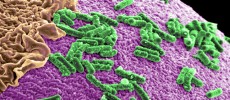 Researchers have discovered that gut bacteria affects the manifestation of the symptoms of Parkinson's disease. (Pacific Northwest National Laboratory - PNNL / CC BY-NC-SA 2.0)