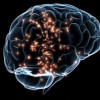 Cocaine Addict's Brain