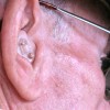 Researchers have revealed that low iron level may affect a patient's hearing capacity. (mike krzeszak/CC BY-ND 2.0)
