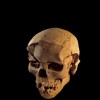 Skull with multiple lesions on front and left side, consistent with wounds from a blunt implement.
