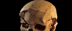 Skull with multiple lesions on front and left side, consistent with wounds from a blunt implement.