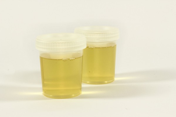 Is urine safe to drink?