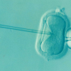  Further scientific backing and proper evaluation are required before the technique would be widely adopted as a safe alternative to improve IVF treatments. 