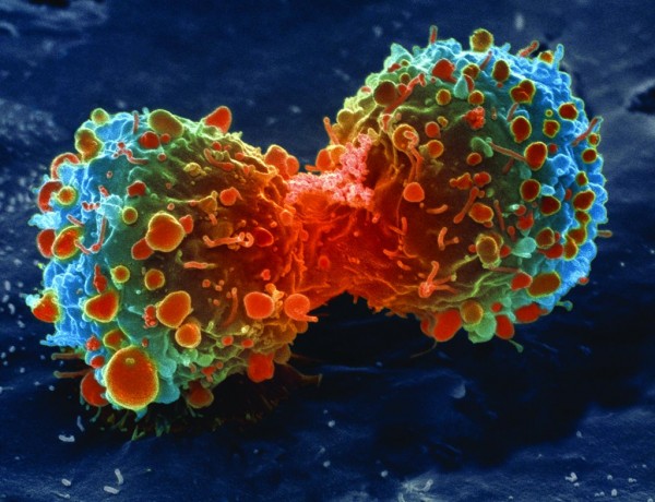 Cancer Cell Division
