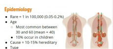 Pheochromocytoma is a rare catecholamine-secreting tumor that can trigger life-threatening hypertension. (YouTube)