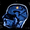 Brain scanner translates locked-in patients' thoughts for communication.