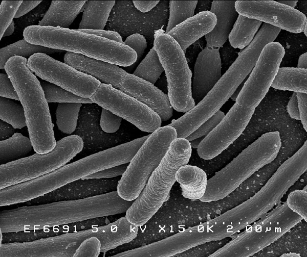 The Salmonella bacteria can be used to fight cancer tumors. (Rocky Mountain Laboratories/NIAID/NIH)