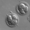  Despite garnering critical scrutiny, the method of altering disease genes among adult human cells through CRISPR-Cas9 has received significant support. (ZEISS Microscopy/CC BY-SA 2.0)