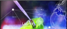 BioSense and Neovacs signed a $68 million deal for the therapeutic vaccine for lupus and dermatomyositis. (YouTube)