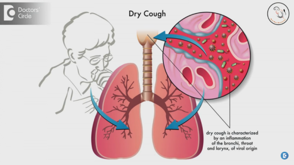 There is no mucus or has only a small amount of mucus in a dry cough and it is accompanied by throat irritation.