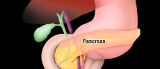 One of the major reasons why pancreatic cancer cannot be diagnosed earlier because it does not produce any signs and symptoms. 