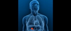 Gallbladder cancer is one of the rarest types of cancer. It often affects certain ethnic groups around the world like the Native Americans in North America, and in other geographic regions like East and Southeast Asia. 