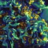 HIV Antibody