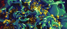 HIV Antibody