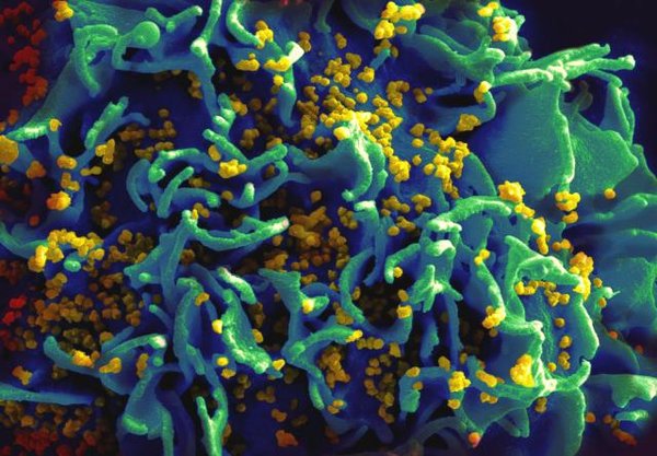 HIV Antibody