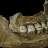 Neanderthal plaque from teeth reveals some very sophisticated human behavior regarding medicinal use. (University of Liverpool)