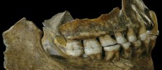 Neanderthal plaque from teeth reveals some very sophisticated human behavior regarding medicinal use. (University of Liverpool)