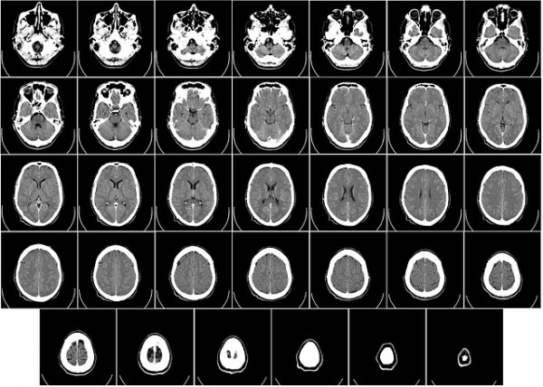  A brain scan could help predict whether a person knowingly committed a crime. 
