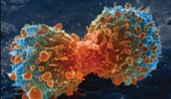 Cancer cells.              