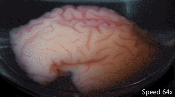 This 3-D, gel model of a smooth fetal brain is coated with a thin layer of elastomer gel, and immersed. 