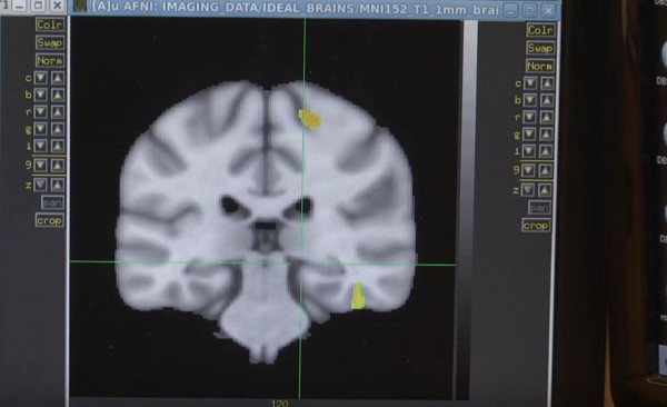 The brain altering device was developed with funding coming from the Brain Research through Advancing Innovative Neuroscience project announced by former US President Barack Obama. (YouTube)