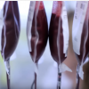 China's Creat Group wants to acquire Germany's blood plasma maker Biotest. (YouTube)