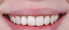 The state of the teeth and gums can reveal the overall health of the body.  (YouTube)