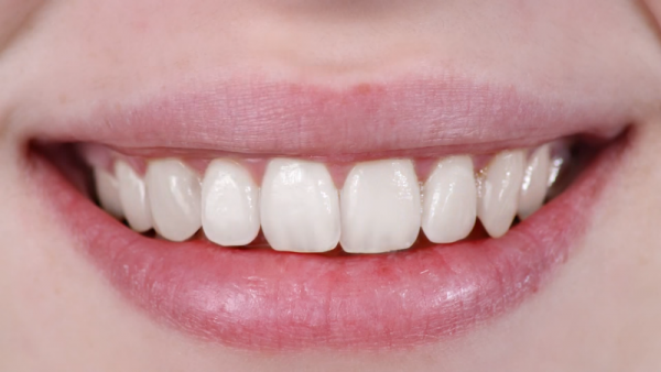 The state of the teeth and gums can reveal the overall health of the body.  (YouTube)