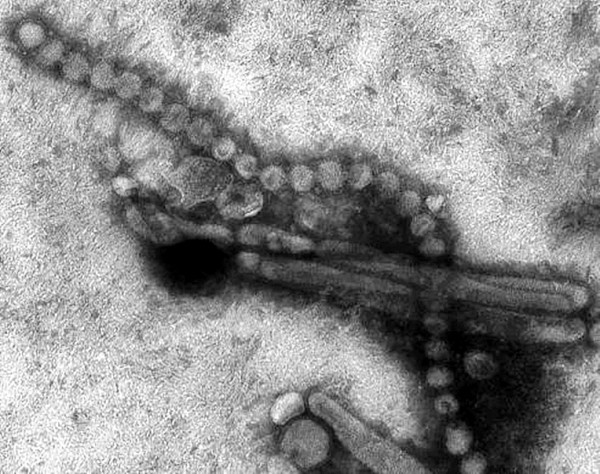 H7N9 virus