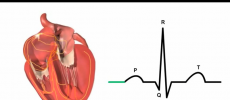 P-QRS-T represents various activations in the heart. (YouTube)