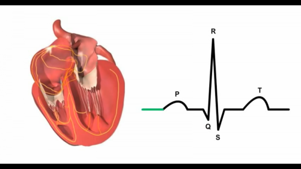 P-QRS-T represents various activations in the heart. (YouTube)