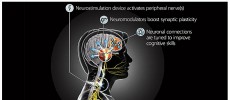 The main goal of the Targeted Neuroplasticity Training (TNT) program is to understand the basic mechanisms linking neurostimulation to plasticity.       