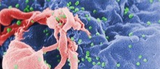 An electron micrograph of the HIV virus in an image courtesy of the CDC. 