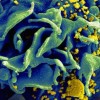 HIV Virus Attacking T Cell