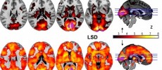 This image shows how, with eyes-closed, much more of the brain contributes to the visual experience under LSD than under placebo. The magnitude of this effect correlated with participants reports of complex, dreamlike visions.