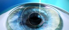 IBM/Bausch & Lomb Cataract Surgery App 