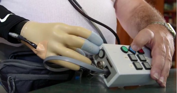 Equipped with Neural Electrical Simulation, amputees are able to relive the experience of using their missing hand.