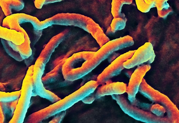 A mutation of Ebola virus has made it easily transmittable to human cells. (Flickr)