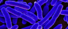 Bacteria such as E. coli apparently behave differently in space. (Flickr)