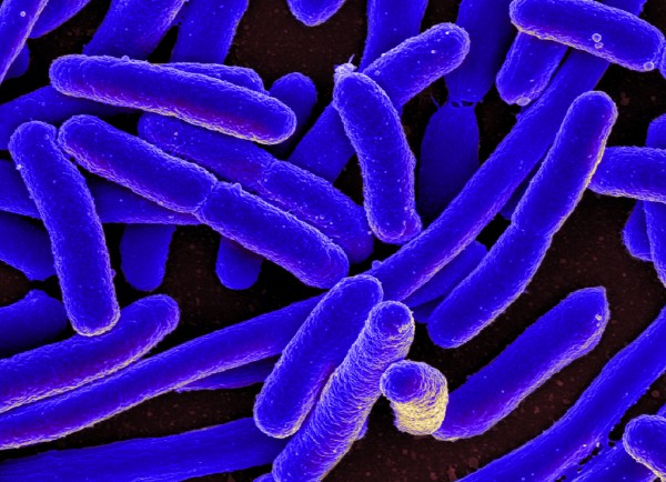Bacteria such as E. coli apparently behave differently in space. (Flickr)