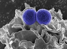 A picture of the Methicillin-resistant Staphylococcus aureus. (Flickr)