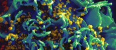 HIV is now listed as a carcinogen. (Flickr)